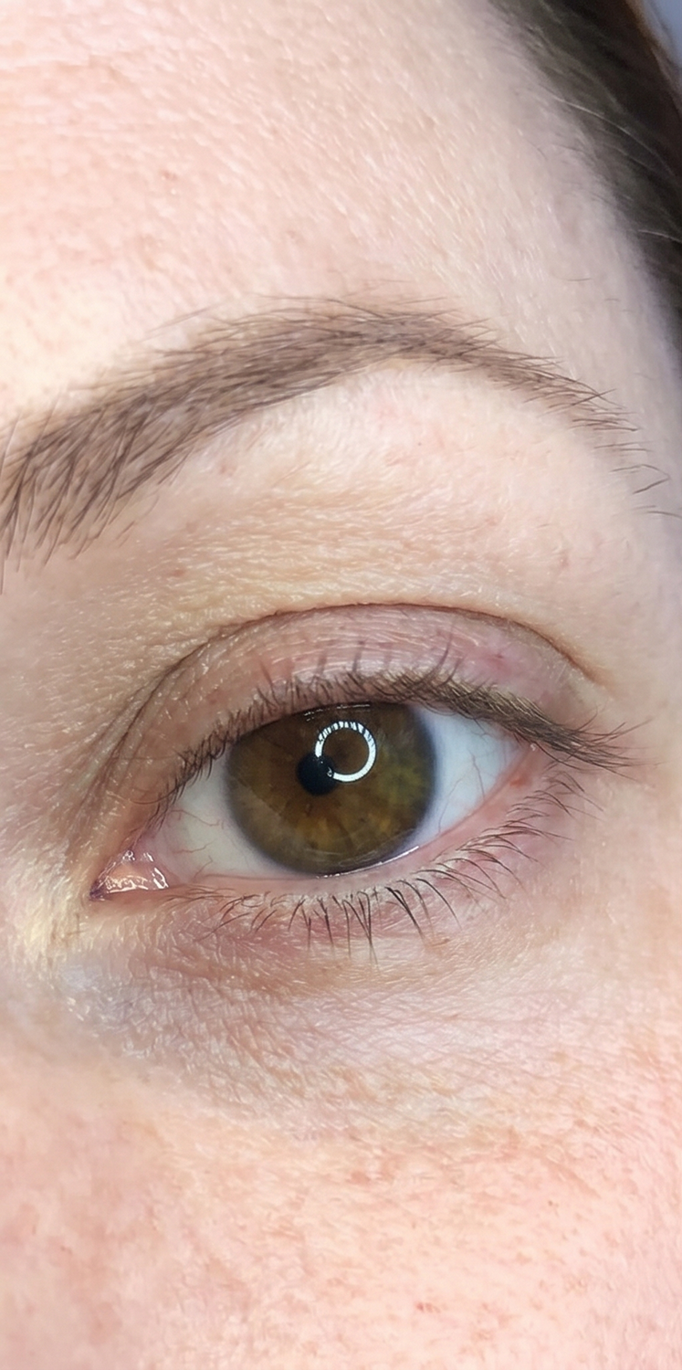 Cils plats, regard alourdi